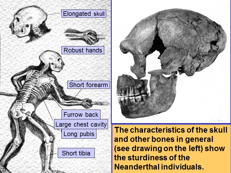 The characteristics of the skull and other bones in general (see drawing on the